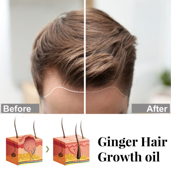 Ginger Repair Hair Follicle Soft Moisturizing And Nourishing Essential Oil - Image 6