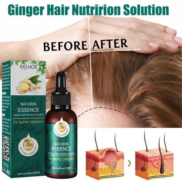 EELHOE Mature Ginger Up Hair Care Essential Oil - Image 5