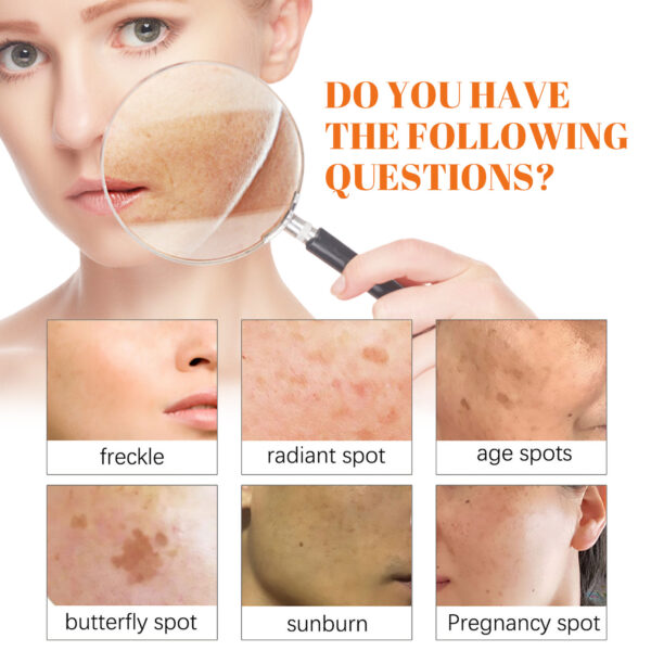 Papaya Brightening Freckles Cream Lightens Freckles And Dark Spots On The Face, Brightens And Moisturizes The Skin, Morning And Evening Cream - Image 3