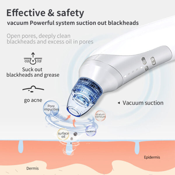 Blackhead Suction Instrument, Electric Blackhead Suction Artifact, Blackhead Removal Instrument, Home Use Beauty Instrument For Sucking Blackheads And Acne - Image 5
