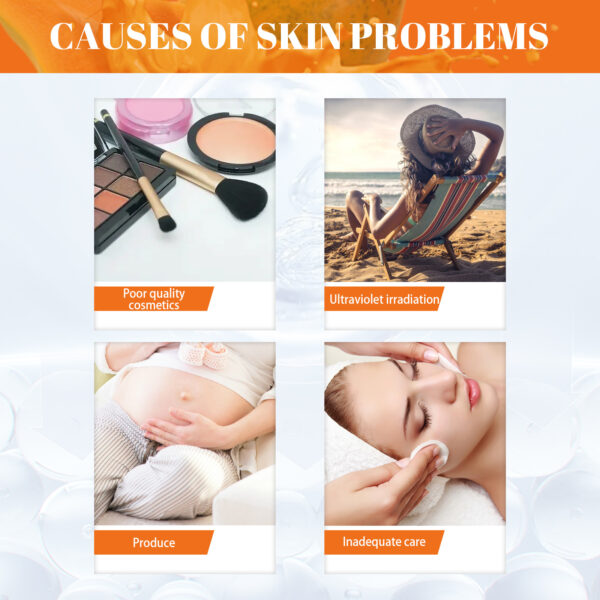 Papaya Brightening Freckles Cream Lightens Freckles And Dark Spots On The Face, Brightens And Moisturizes The Skin, Morning And Evening Cream - Image 6