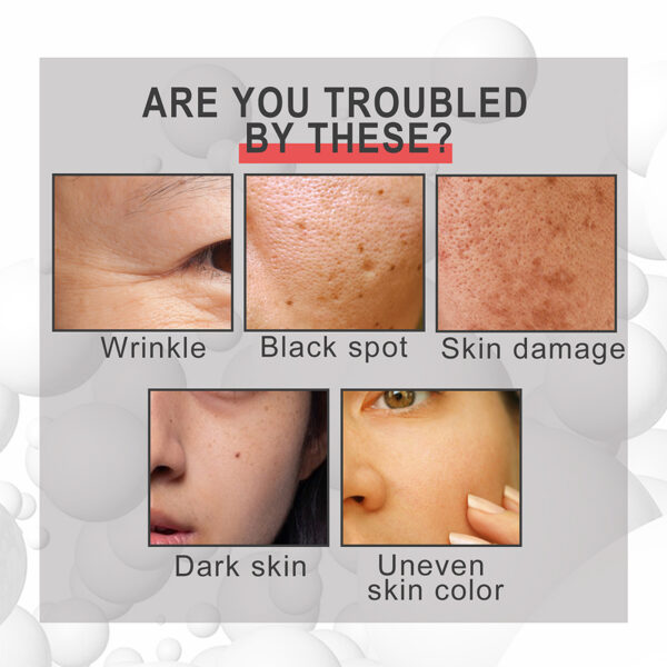 Anti-aging Cream-Fade Fine Lines On The Face, Nasolabial Folds, Repair Firm, Moisturize The Skin, Anti-wrinkle Cream - Image 2