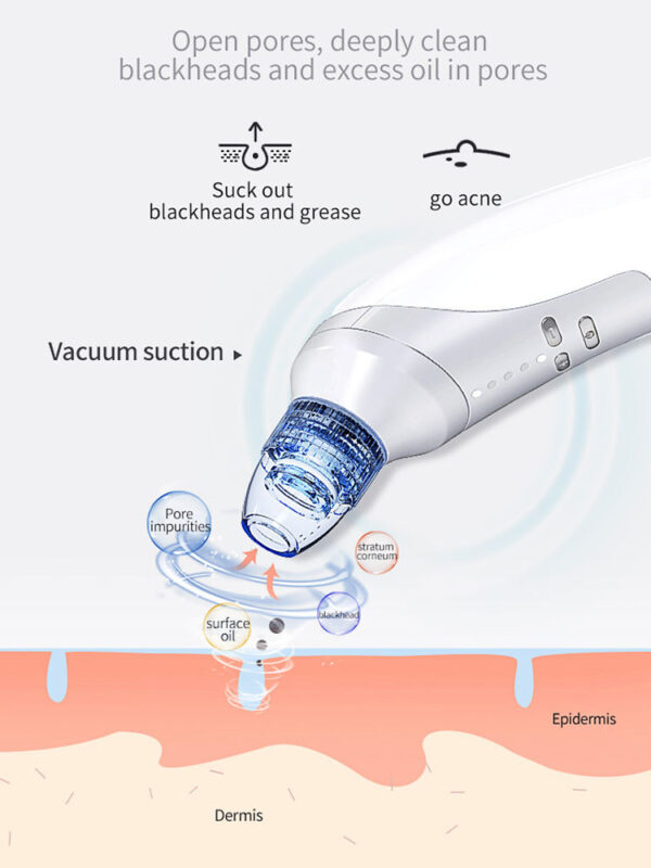 Blackhead Suction Instrument, Electric Blackhead Suction Artifact, Blackhead Removal Instrument, Home Use Beauty Instrument For Sucking Blackheads And Acne - Image 4