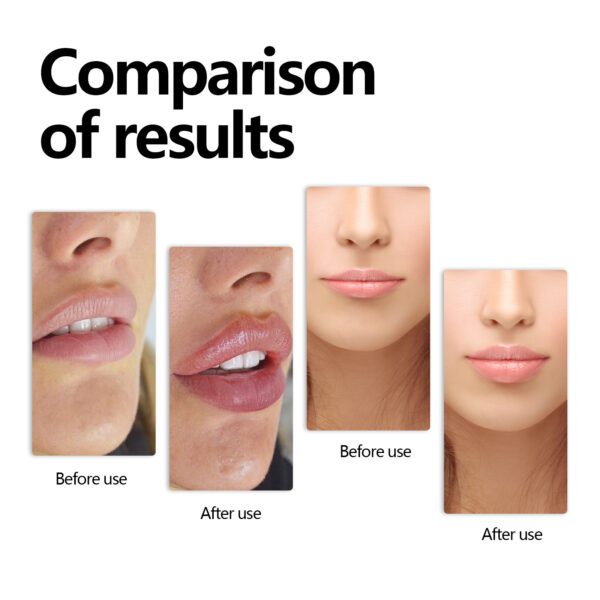 EELHOE Lip Serum Lip Moisturizing, Anti-Cracking, Hydrating, Hydrating And Smoothing Lip Lines - Image 9