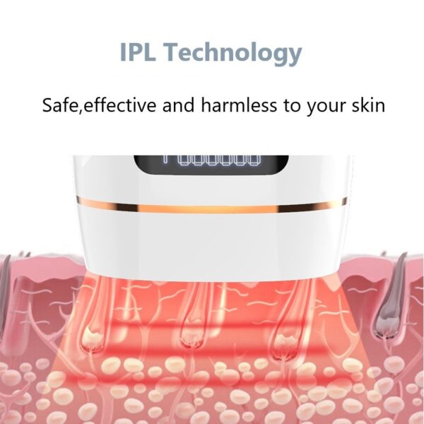 Fashion Personality Home Laser Hair Removal Device - Image 4